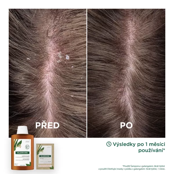 KLORANE Šampon proti lupům s galangalem 200 ml