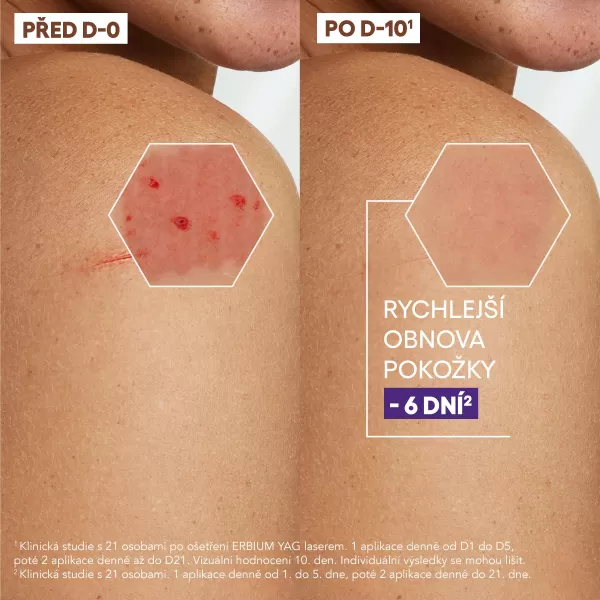 A-Derma Epitheliale Ultra Repair Regenerační krém 40 ml